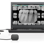 picture of Digital Radiographs (X-Rays)